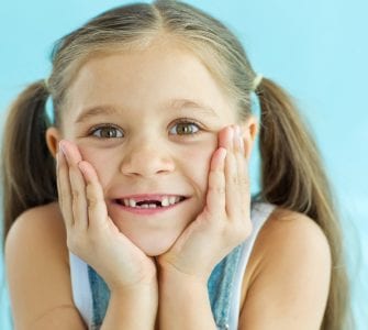 disfagia Dentes de leite