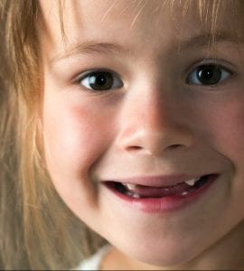 Destaque - Displasia: como identificar os primeiros sinais