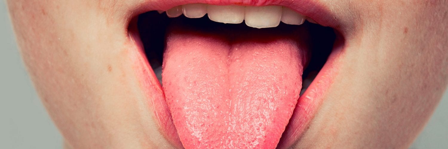 doenças da língua