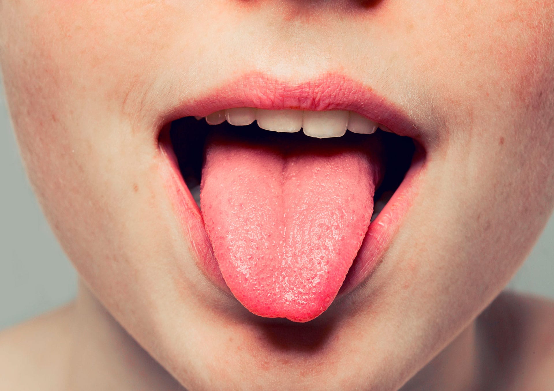 É normal ter um caroço no céu da boca? - Blog Dentalclean