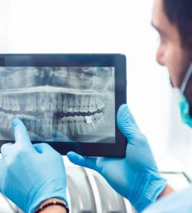 Raio X de dente