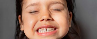 Hipoplasia do esmalte