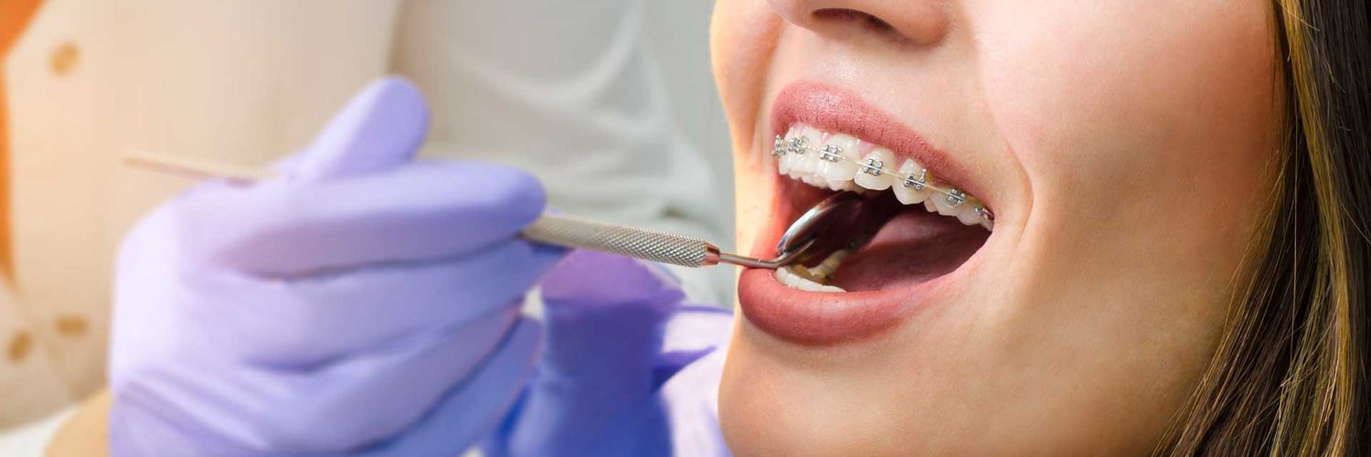 Manutenção do aparelho