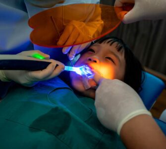 aplicação de flúor