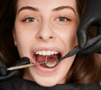 mancha preta no dente