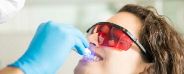 clareamento de dente desvitalizado