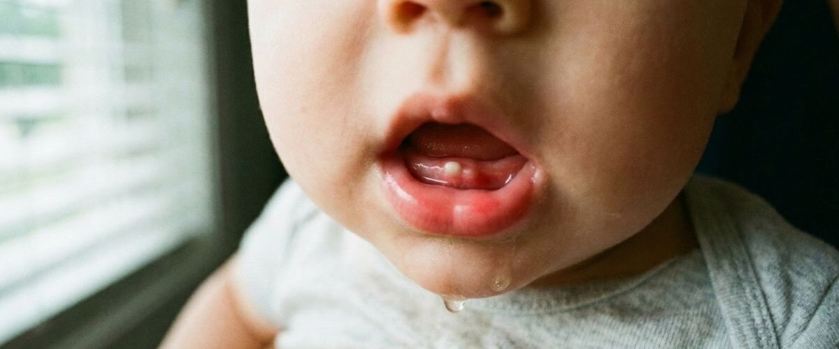 fotos da gengiva do bebê quando vai nascer dente