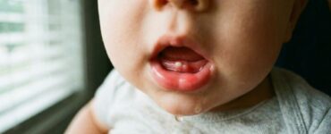 fotos da gengiva do bebê quando vai nascer dente