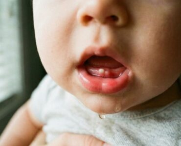 fotos da gengiva do bebê quando vai nascer dente