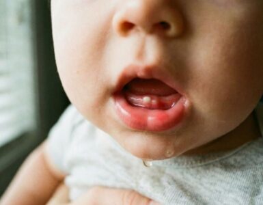 fotos da gengiva do bebê quando vai nascer dente