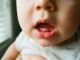 fotos da gengiva do bebê quando vai nascer dente