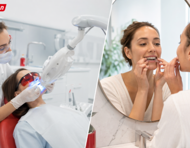 clareamento profisional