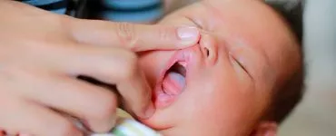 Língua do bebê branca